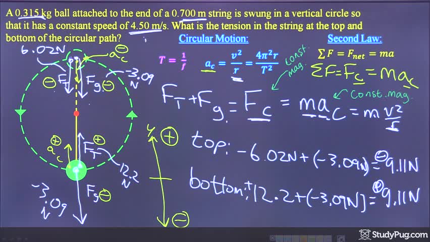 Finding string tension at the top and bottom of a vertical circle
